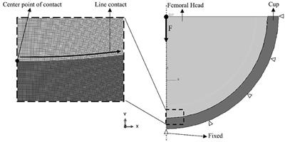 Reducing Contact Stress of the Surface by Modifying Different Hardness of Femoral Head and Cup in Hip Prosthesis